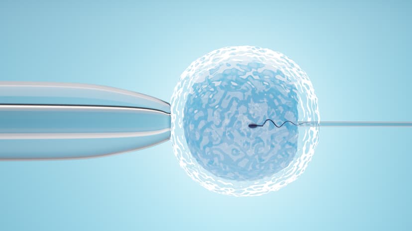 IVF ICSI