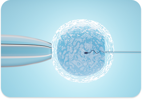 Frozen Embryo Transfer: A Second Chance for Success